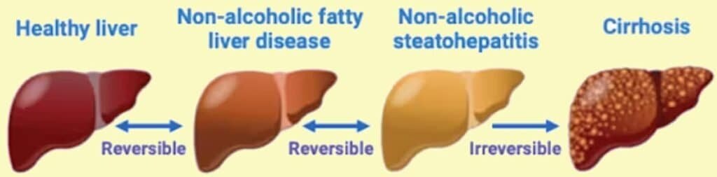 states of liver condition